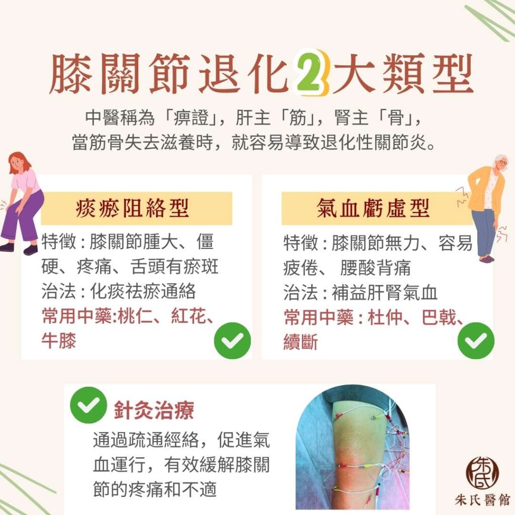 膝關節退化兩大類型